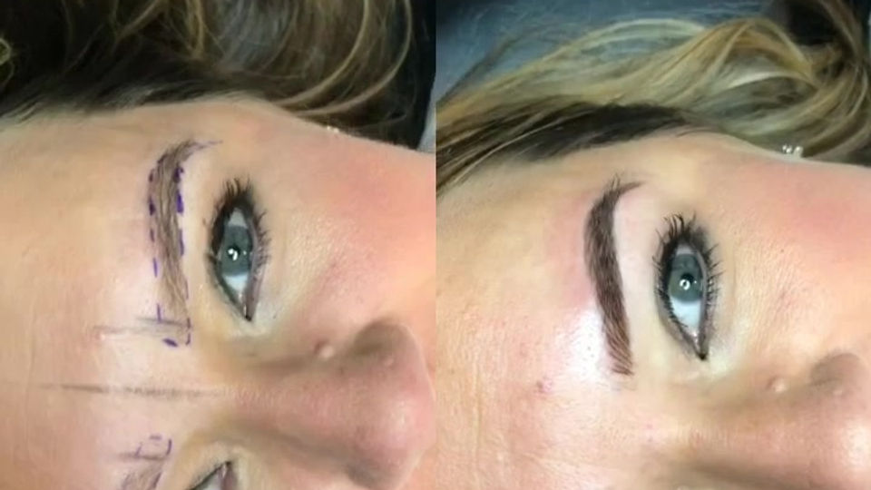 COMBO BROW TRANSFORMATION
